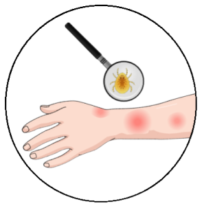 PROFILAKTYKA PRZECIW-KLESZCZOWA
